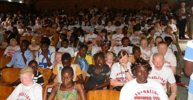 Femmes albinos réunies par la FMT