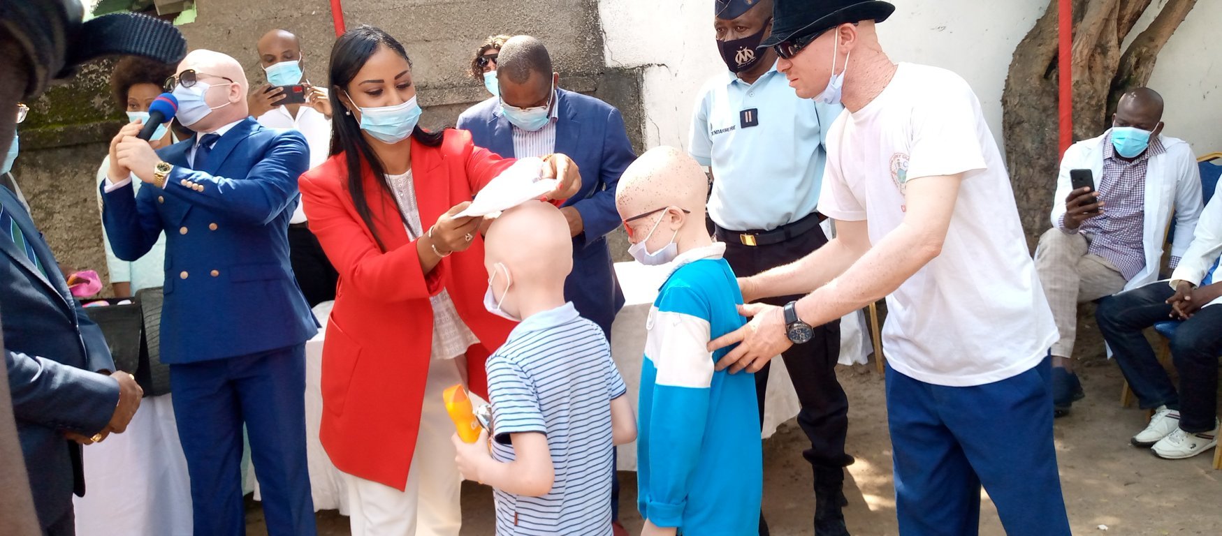 Public health: launch of the albino skin cancer treatment campaign